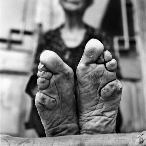 Powerful Photo Series Documents the Final Generation of Foot Binding in China