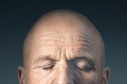 Nickerchen können Zeichen für Alzheimer sein! Was dahintersteckt