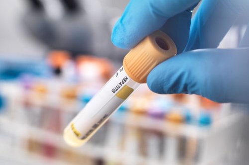 Verdopplung der registrierten Hepatitis-B-Fälle binnen eines Jahres