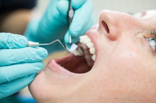 Was nützt eine professionelle Zahnreinigung wirklich?