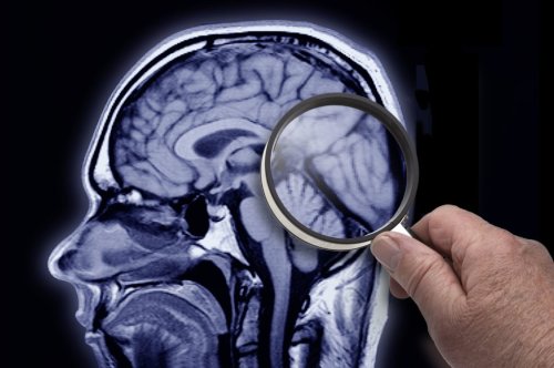 Der erstaunliche Effekt von Magnesium auf die Gesundheit des Gehirns