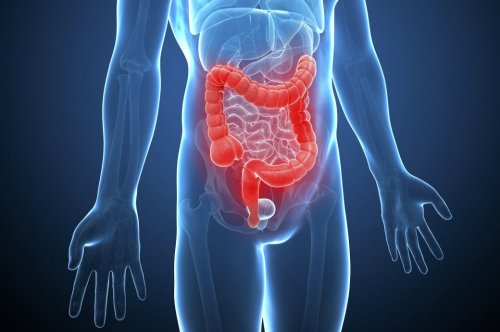Morbus Crohn – Symptome, Risikofaktoren, Behandlung