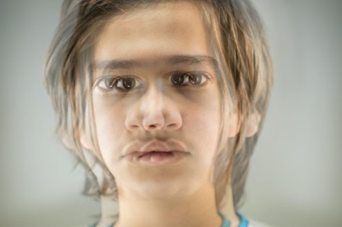 Schizophrenie – Ursachen, Symptome und Behandlung