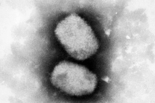 Keine neue Pandemie: Fachleute warnen vor zu viel Aufregung um Affenpocken - FIT FOR FUN