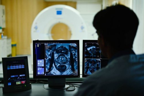 Gesundheit Prostatakrebs: So erkennst du die Symptome frühzeitig