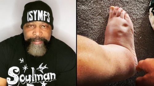 Watch: Powerlifting Legend CT Fletcher Shares Reaction from Anti-Rejection Medication
