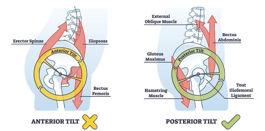 5 Exercises to Correct an Anterior Pelvic Tilt to Release Back & Hip Pain