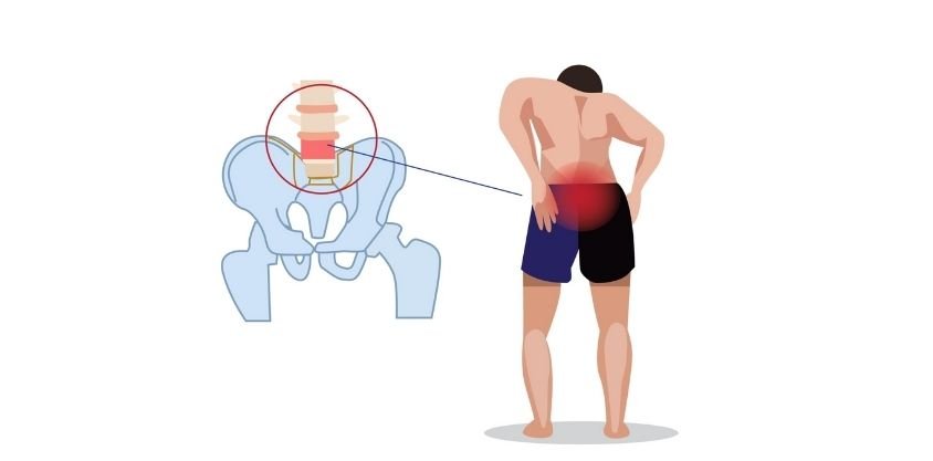 Nothing Soothes Your Radiating Back Pain Like This 30-Second Back Stretch