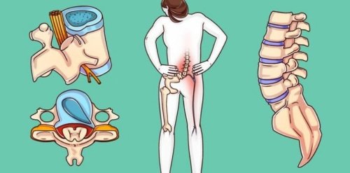 A Surgeon Reveals Exercises That Can Heal Your Spine Before It’s Too Late
