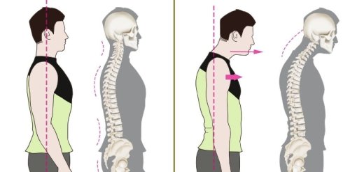 How To Fix Forward Head Posture: 3 Stretching Exercises to Try
