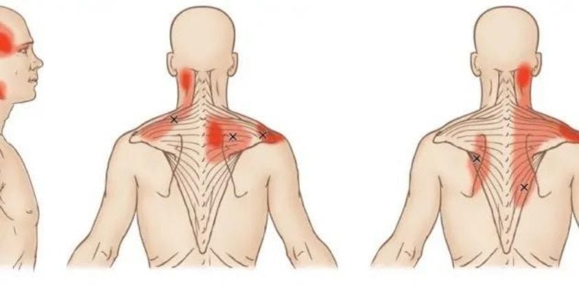 3 Gentle ‘Muscle-Release Movements’ To Relieve Upper Back Pain and Ease Tension At Home