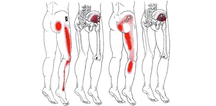 10 Piriformis Stretches To Get Rid Of Sciatica, Hip, And Lower Back Pain