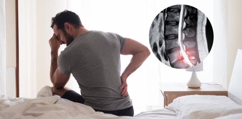 If You Wake Up With Back Pain, Do These 4 Exercises for Relief