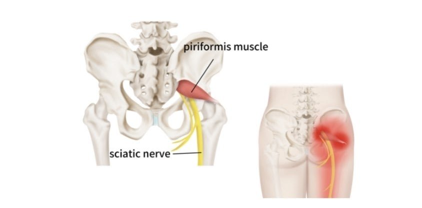 This Piriformis Muscle Stretch Helps Ease the Nerve Tension in Your Glutes and Legs