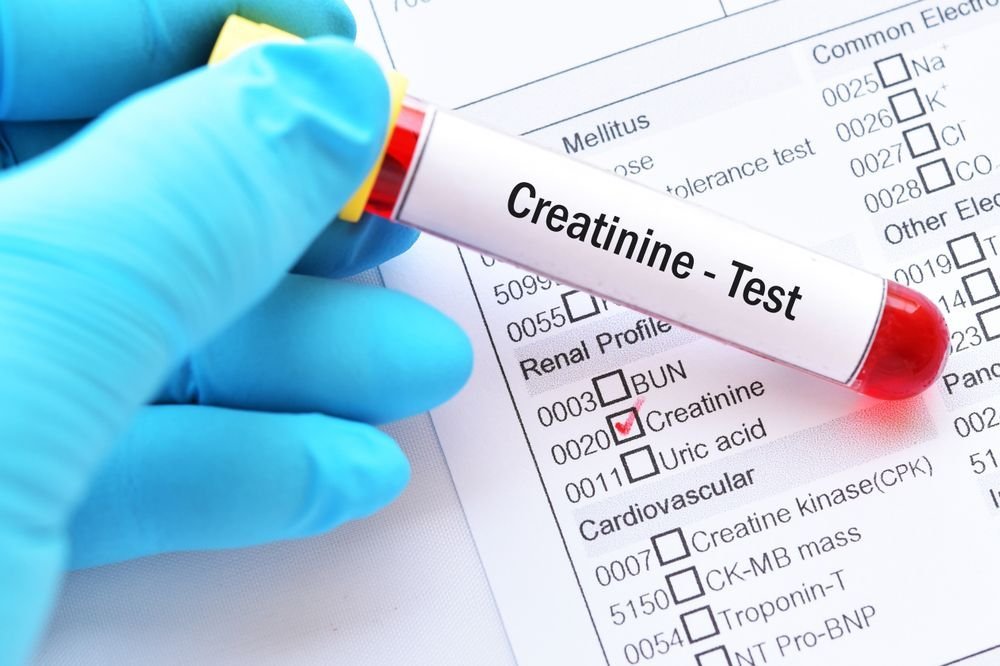 How to Lower Creatinine Levels Fast — Plus Kidney Problems to Be Aware Of