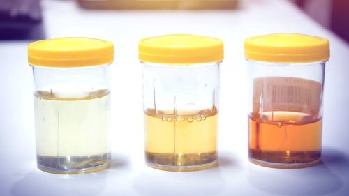 What Your Urine Color Can Tell You About Your Health