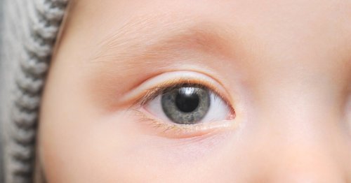 AI-screened eye pics diagnose childhood autism with 100% accuracy