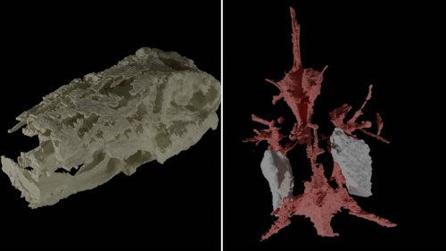 Oldest example of well-preserved vertebrate brain found in 319-million-year-old fossilised fish