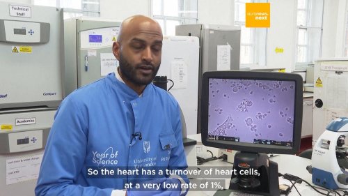 These lab-grown hearts made from human stem cells are used to train AI to detect heart diseases