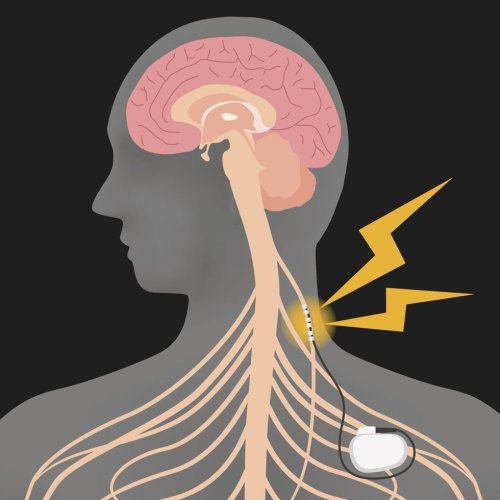 Vagus Nerve: How it helps reduce anxiety