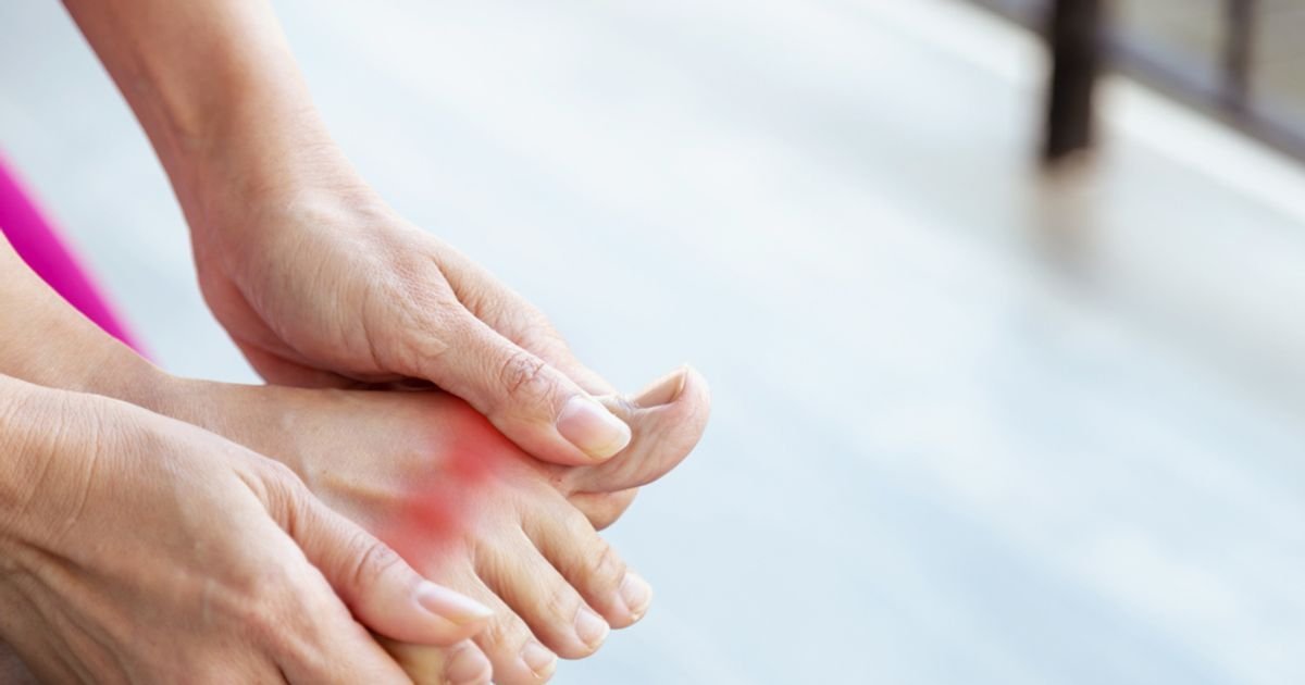 Early Signs of Gout