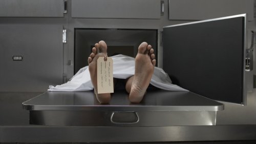 Here's What Happens To Your Skin Just After Death