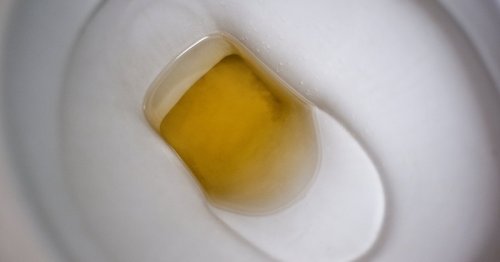 What's that smell? Here are the weird colors and smells behind your pee