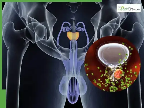 Magazine - Prostate Health