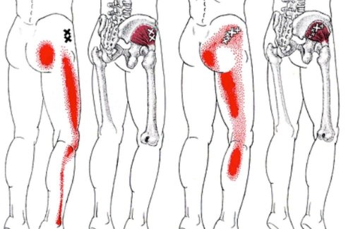 How To Get A Deep Piriformis Stretch To Get Rid Of Sciatica, Hip & Lower Back Pa