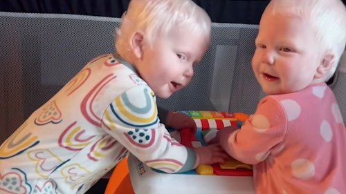 My twin daughters were born with albinism - people gawk at them in the street