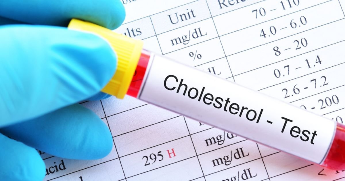 Common Myths and Misconceptions About Cholesterol