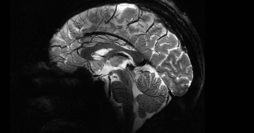 World's most powerful MRI machine captures first stunning brain scans