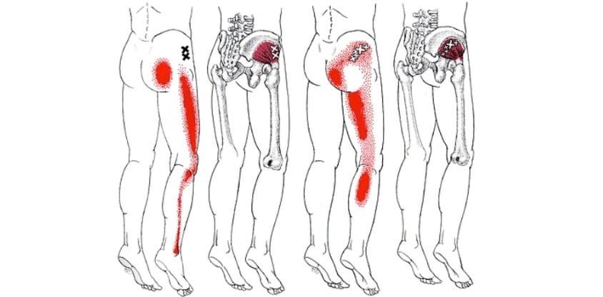 Deep Piriformis Stretches To Eliminate Sciatica, Hip, and Lower Back Pain