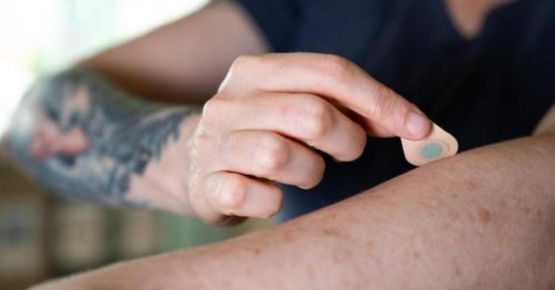 New do-it-yourself microneedle tattoos are painless, quick and cheap