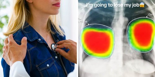 Pulmonologist illustrates why he’s concerned that AI will take his job