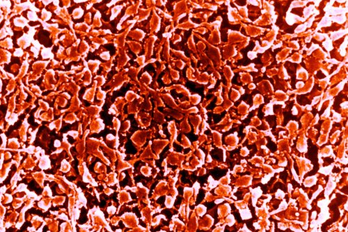 Is Walking Pneumonia Contagious? (And Other Questions, Answered)