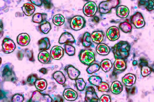 Measles Cases Have Just Been Confirmed in 4 More States
