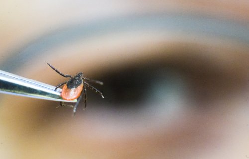 Got ticks? Here's how to remove and kill them, according to experts