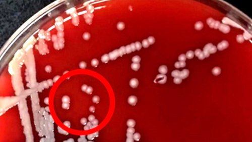 Scientists Identify Depression Causing Enzyme In the Gut