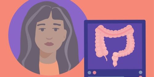 Mental Health Ups and Downs With Colon Cancer