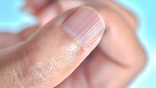 Do You Have Ridges On Your Nails? Here's What That Means