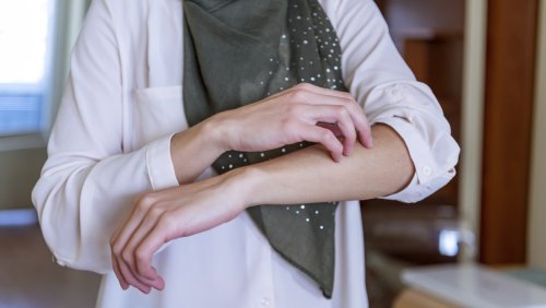 How To Tell If Your Itchy Skin Could Be Cancer