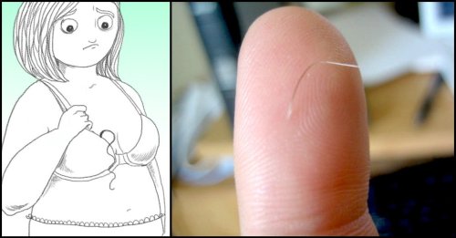  Is Nipple Hair Normal? What You Need To Know About Sprouting Hair ‘On There’