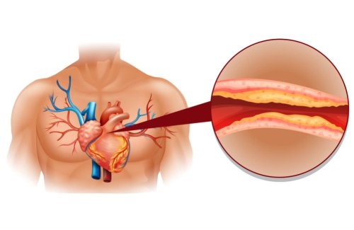 10 Foods That Will Clean Your Arteries Naturally And Protect You From Heart Atta