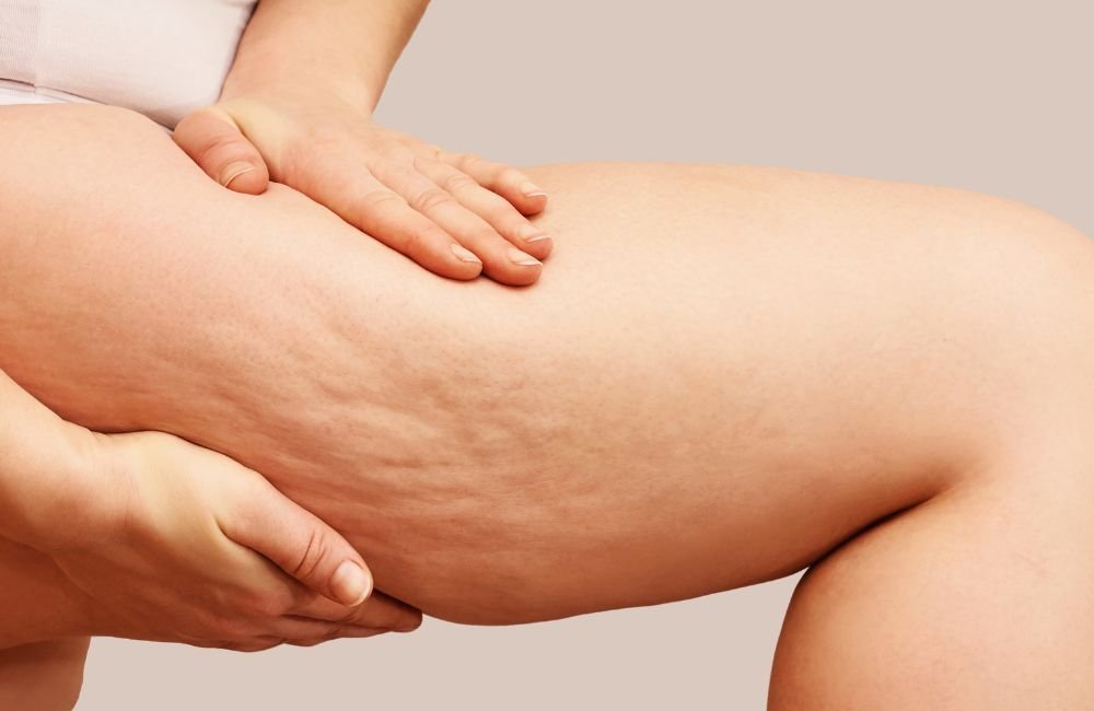 3 Simple Exercises to Lose Leg Fat