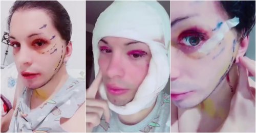 A Man Spends $80,000 On Plastic Surgery To Transform Himself Into A ‘Space Elf'