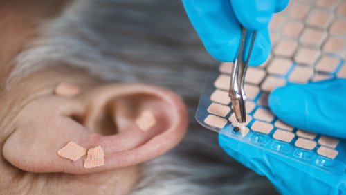 What To Expect When You Use Ear Seeds, According To An Acupuncturist 