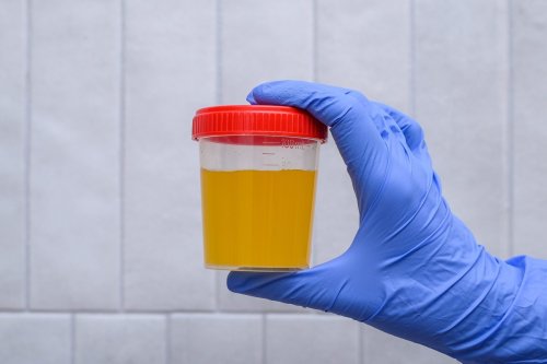 This Test Predicted Sudden Cardiac Arrest Risk for One Surprising Group