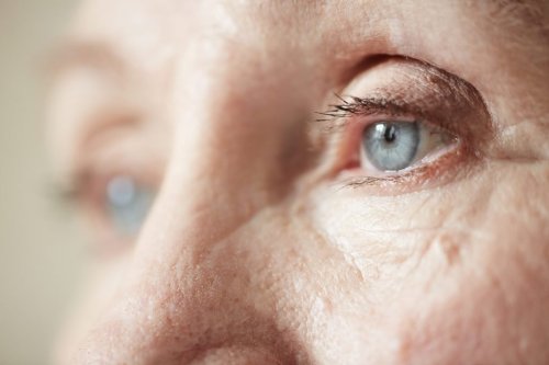 "Here’s How I Knew I Had Glaucoma": A Patient’s Story