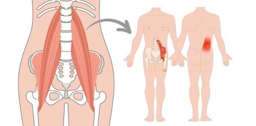 Your Back Is Begging for These 6 Stretches That Stop Pain Instantly